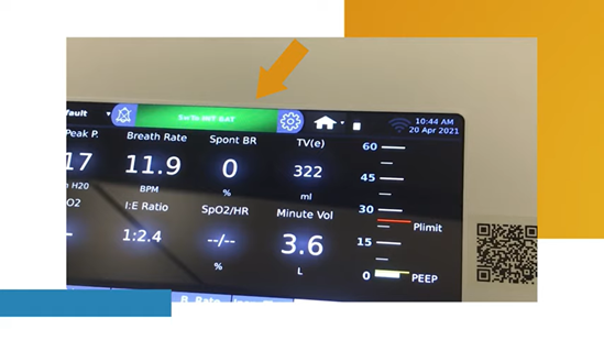 Mechanical ventilator close up